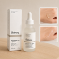 Niacinamide 10% + Zinc 1% Serum 30ml for Oily & Acne-Prone Skin