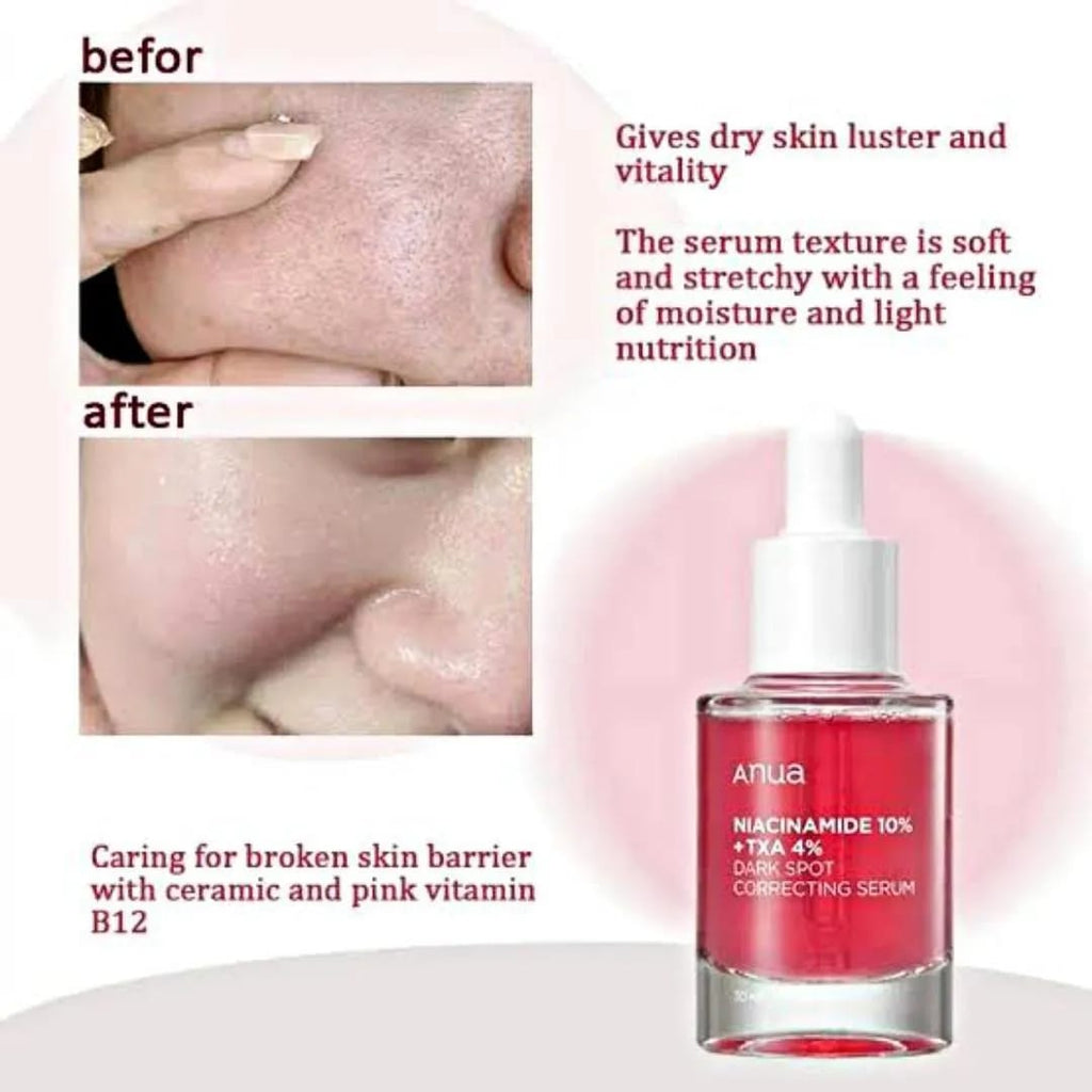 Anua Niacinamide 10% + TXA 4% Dark Spot Serum 30ml